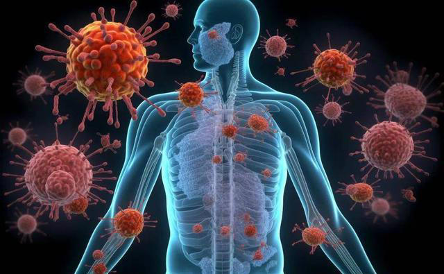 医生忠告：肺癌早期不是咳嗽，而是频繁出现这5症状，千万别忽视