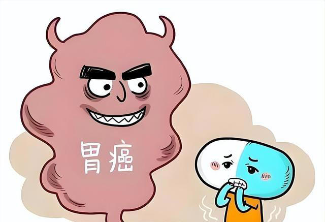 医生提醒：胃癌早期不是反胃，而是频繁出现这4症状，千万别忽视