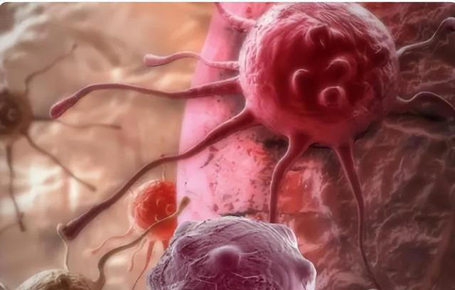 癌症是基因注定的，躲也躲不掉？医生：5种癌，或会代代相传