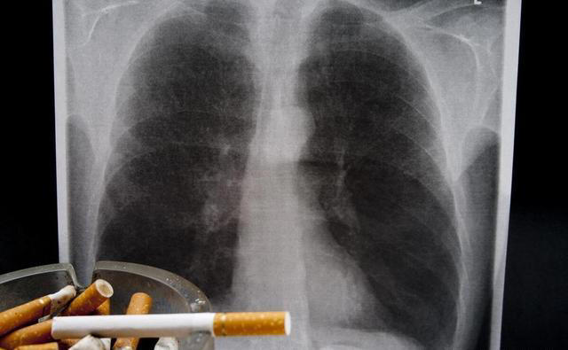 一天抽两包烟VS两天抽一包烟，哪个危害更大？4个方面真要重视