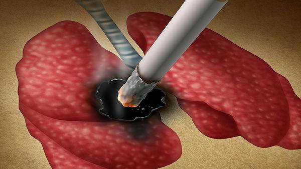  戒烟后偶尔抽一支影响大吗？医生分析：这种行为要不得 