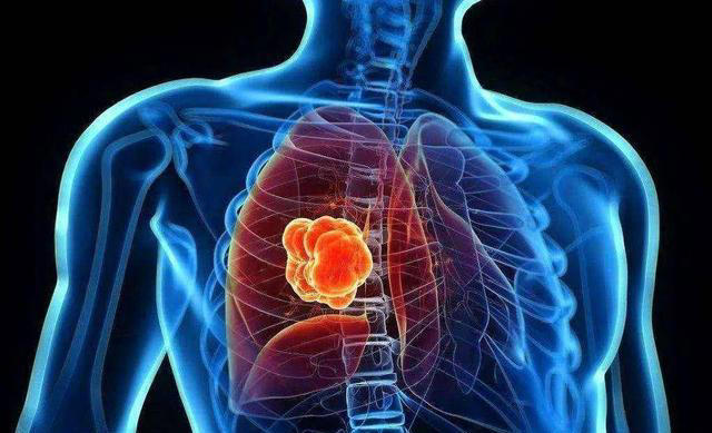 成功戒烟后，肺还能恢复正常吗？医生：戒烟别超过这个岁数