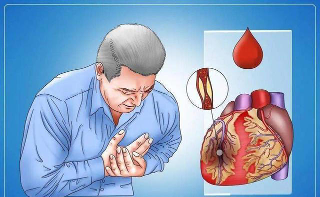 学医后才知道，心脏最危险信号，不是胸闷，而是频繁出现6症状