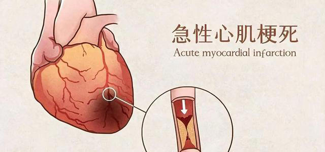 学医后才知道，心脏最危险信号，不是胸闷，而是频繁出现6症状