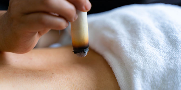 艾炙的作用与功效详解——传统疗法的现代应用