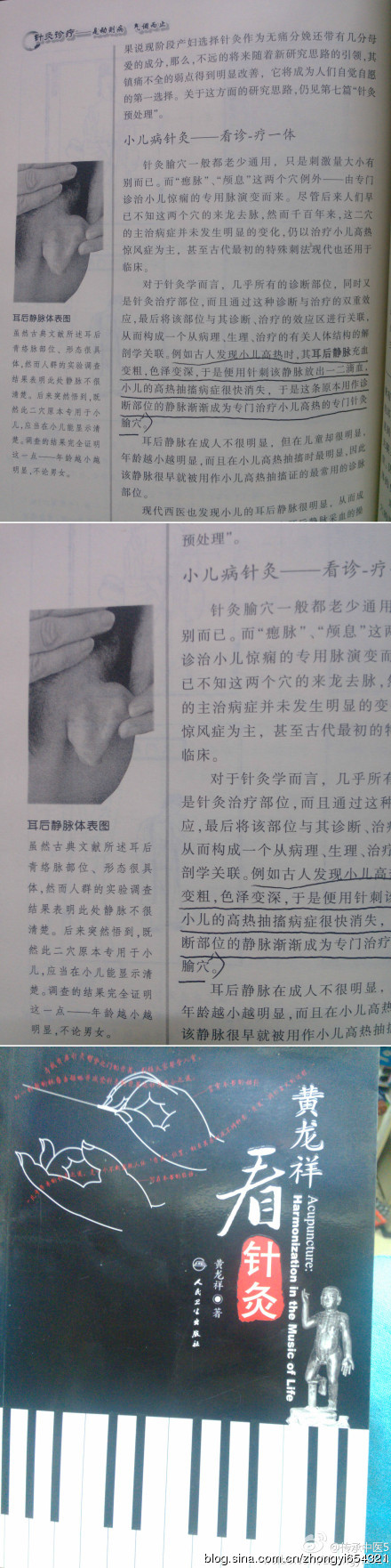 儿科常见问题老中医的解决办法(收藏) 69451f39gdfb4d458766f&690