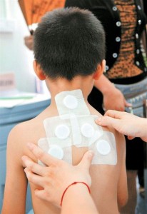 家传儿科敷贴疗法