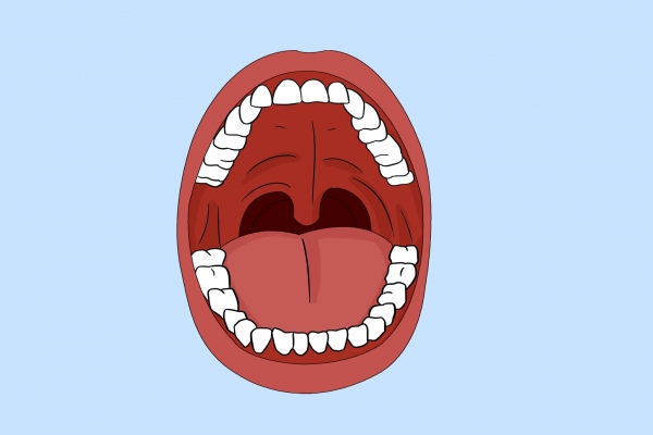 口腔癌早期症状有哪些 有口腔病史者如何预防口腔癌