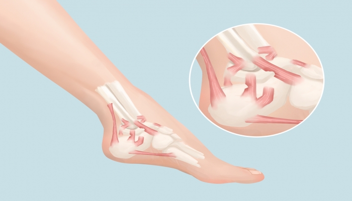 脚踝内侧是什么穴位 刺激穴位时要注意什么