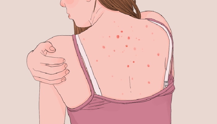 湿气重按什么穴位 湿气重可以怎么调理