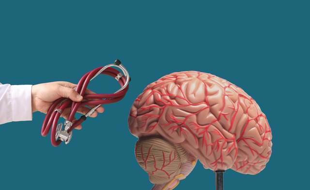 脑梗后还能活多久？医生坦言：关键看这4点，很多人仍有长寿机会