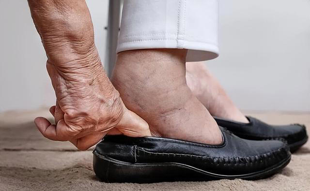 枸杞被点名！医生提醒：肾病患者常吃枸杞，很快或迎来这些后果