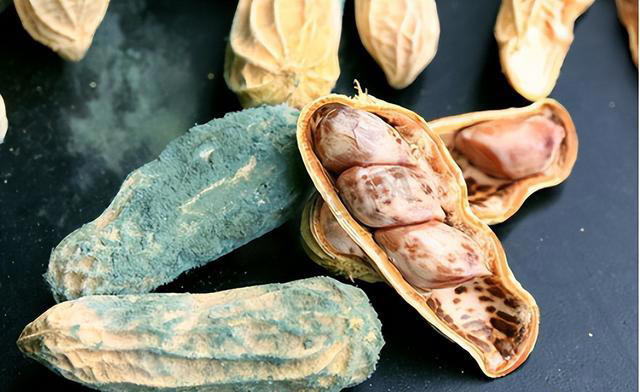 医生劝告：胃癌早期不是反胃，而是频繁出现这3症状，别不当回事