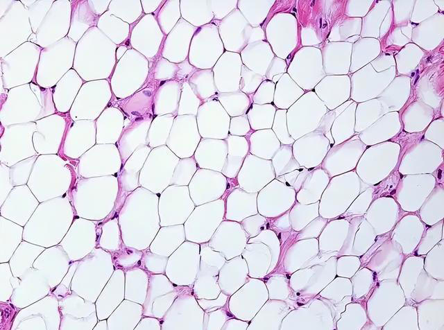 人不会无故患上高血压，研究发现：患上高血压，背后有5点原因