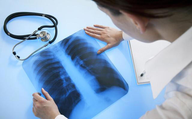 医生再次强调：肺部有结节的人，身上基本有这4个表现，千万注意