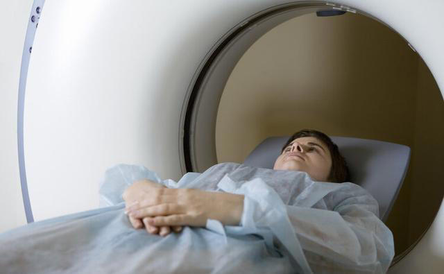 医生再次强调：肺部有结节的人，身上基本有这4个表现，千万注意