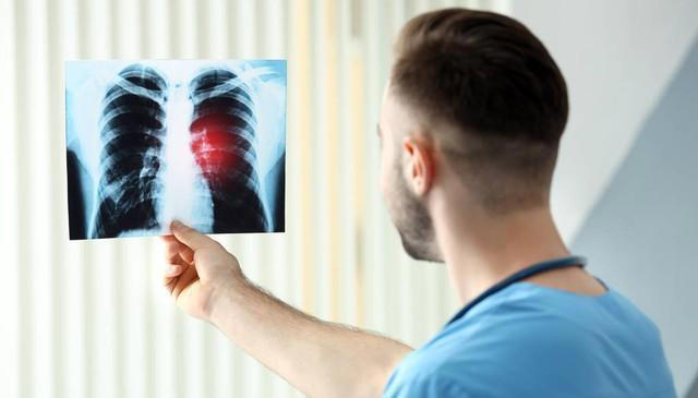 肺癌一查就是晚期？其实双腿早早给了提示！有4个迹象，需早检查