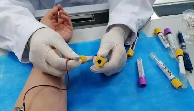 中国脑梗发病率世界第一！医生告诫：真凶已揪出，这5物最好少吃