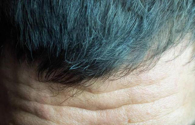 男性开始衰老的表现：2大3软1处变白，若没有，或是好事