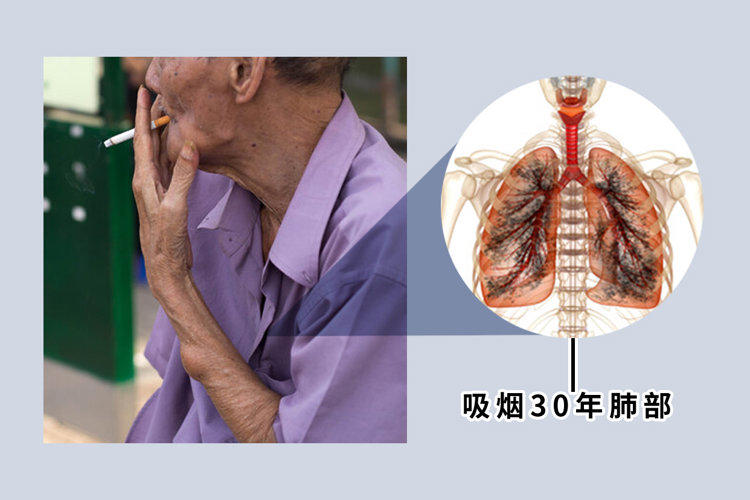这4种香烟已被列入“黑名单”，吸烟的人请注意，最好别抽！