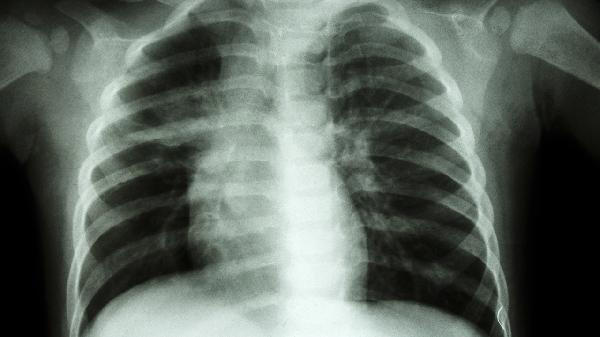 猝死不是突然发生的，这些信号早就提醒过你