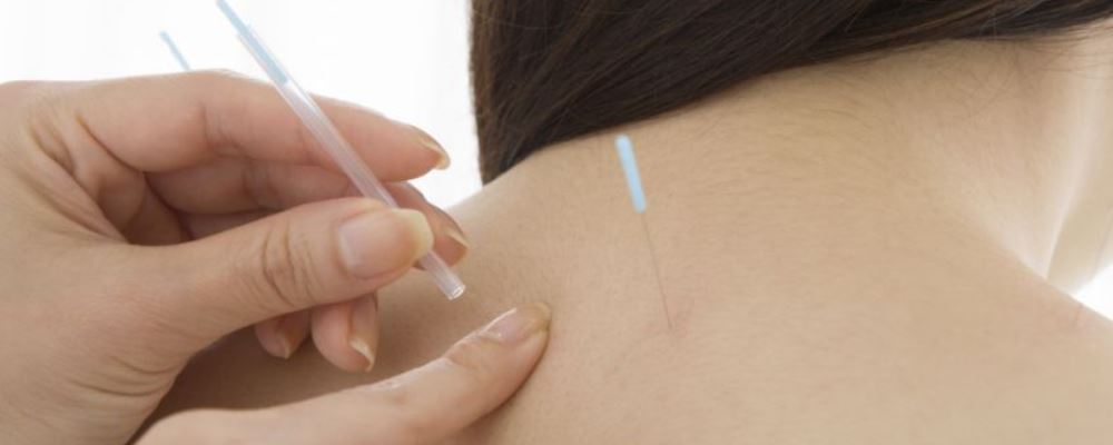 湿热体质如何调理 中医针灸助排湿