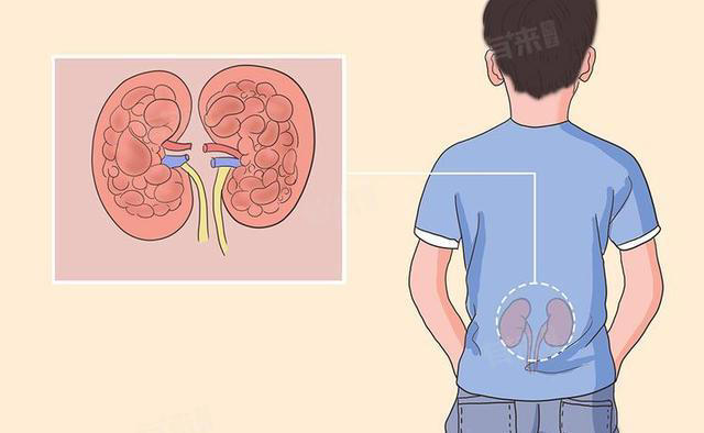 学医后才知道，肾病最危险信号，不是腰酸，而是持续出现4种异常