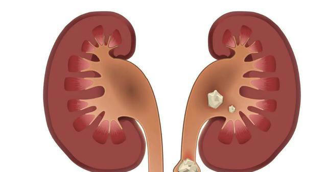 为什么吃之前要焯水？提醒：很多人不懂，以后别再直接下锅了