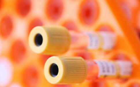 老人体检 心理检查很重要