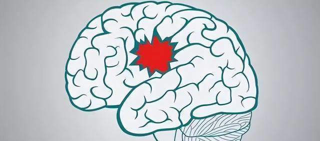 啥是脑供血不足？有什么表现？日常改变8个习惯，保护血管健康！