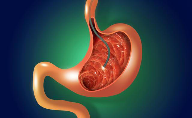 学医后才懂，胃癌最危险信号，不是腹痛反胃，而是持续出现3异常