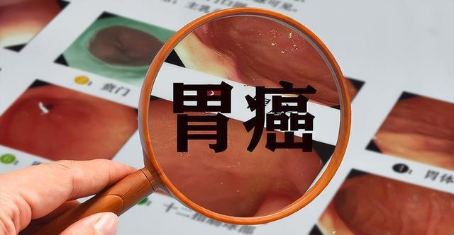 学医后才懂，胃癌最危险信号，不是腹痛反胃，而是持续出现3异常