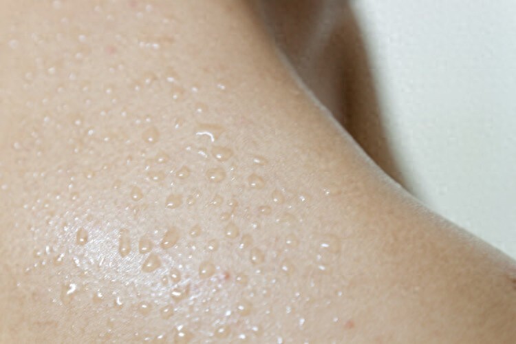 体内有疾，出汗先知？医生提醒：容易出汗的人，排查一下这4种病