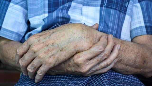 有的人长满“老年斑”，有的却干干净净?医生说出实情