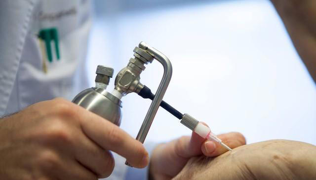 有的人长满“老年斑”，有的却干干净净？医生说出实情