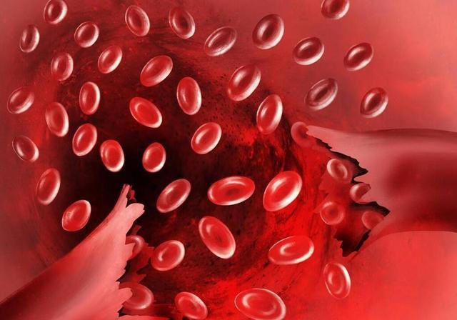 头痛到底是不是“脑子有病”？脑科医生：出现这5种情况有可能是