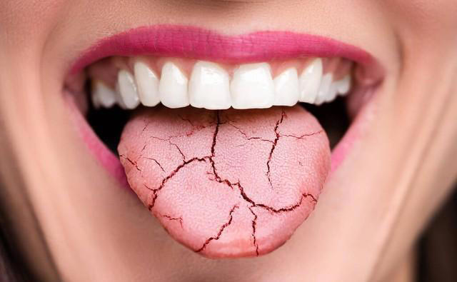 吃饭总咬到舌头，说明想吃肉？并无关，多半是3个原因所致