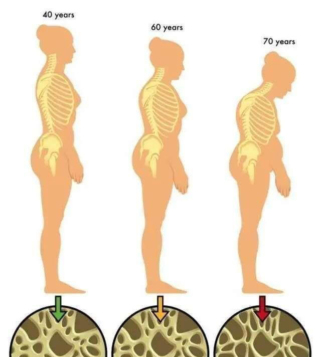 肌肉流失并非不可控，人到中年如何留住肌肉，保持健康与活力？