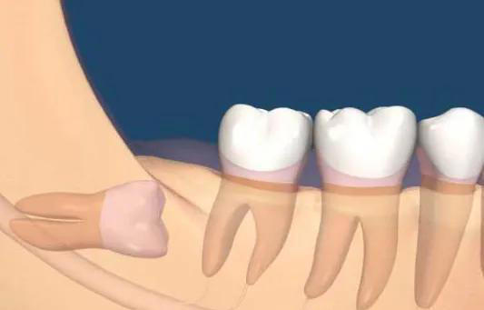 人被拿掉哪些器官不会死？身体的6个“无用”器官，你知道几个