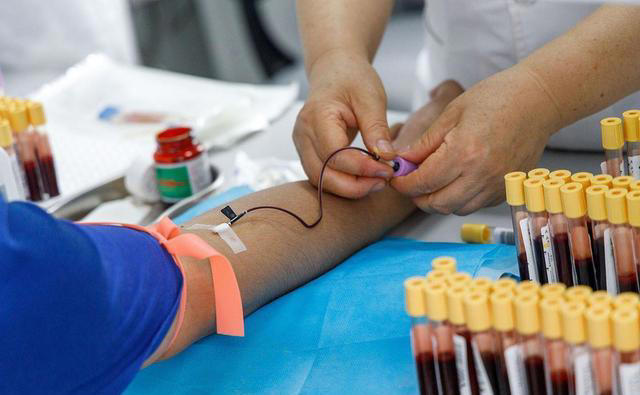 耳鸣是大病的征兆，经常耳鸣的人，或是体内潜藏了这4种疾病