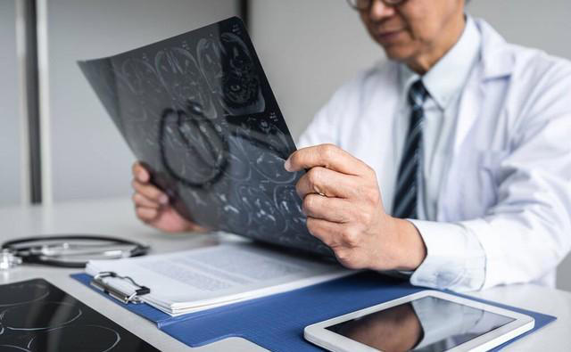 脑供血不足会有哪些表现？医生提醒：做好这几点，避免进展