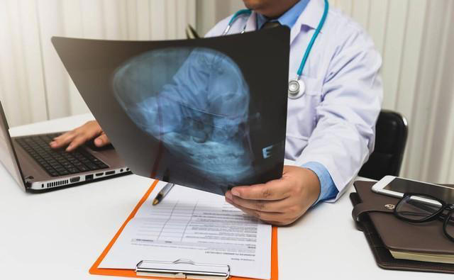 脑供血不足会有哪些表现？医生提醒：做好这几点，避免进展