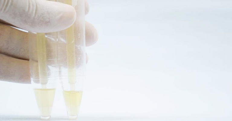 肾不好的人，身体若出现这3种变化，多留意，当心发展成肾衰竭