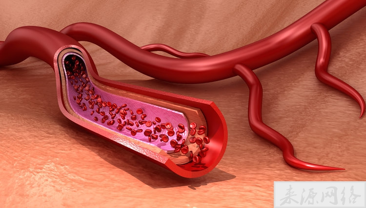 为什么砍胳膊不会死，割腕会死？