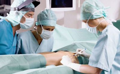 脂肪填充后如何防止并发症 脂肪填充有哪些缺陷 脂肪填充怎么样