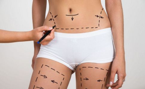 吸脂术是什么？警惕6大危害