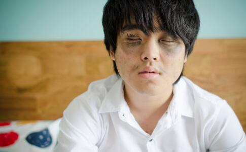 为什么会有黑眼圈 导致黑眼圈的9个原因