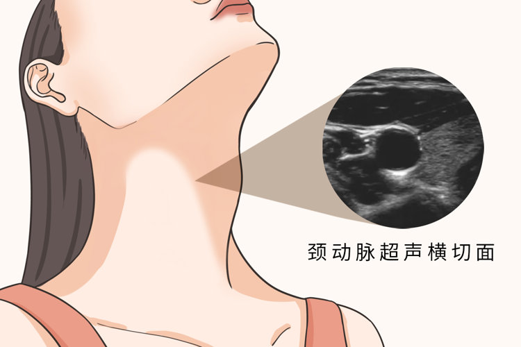 研究发现：血管变硬，或早餐吃错