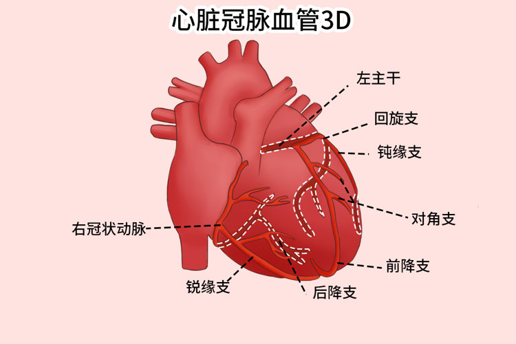 研究发现：血管变硬，或早餐吃错