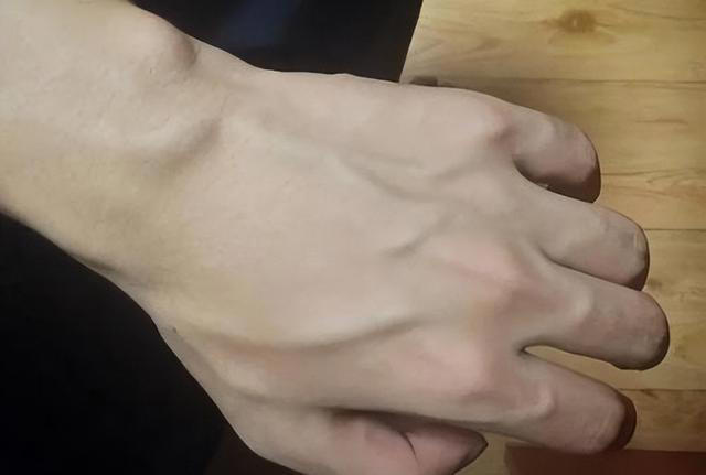 为何有些人手臂“青筋暴起”，有人却看不到“青筋”，看完明白了